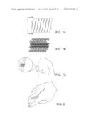 SOFT TISSUE AUGMENTATION THREADS AND METHODS OF USE THEREOF diagram and image