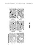 TREATMENT OF PERITONEAL INJURY USING JAK INHIBITORS diagram and image