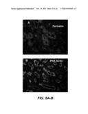 TREATMENT OF PERITONEAL INJURY USING JAK INHIBITORS diagram and image