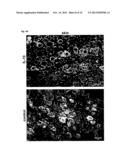 USE OF INTERLEUKIN 10 MRNA TRANSFECTED MACROPHAGES IN ANTI-INFLAMMATORY     THERAPIES diagram and image