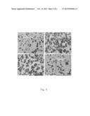 Method of Using Tea Polyphenols for Prevention and Treatment of Malignant     Tumors in a Hematopoietic System diagram and image