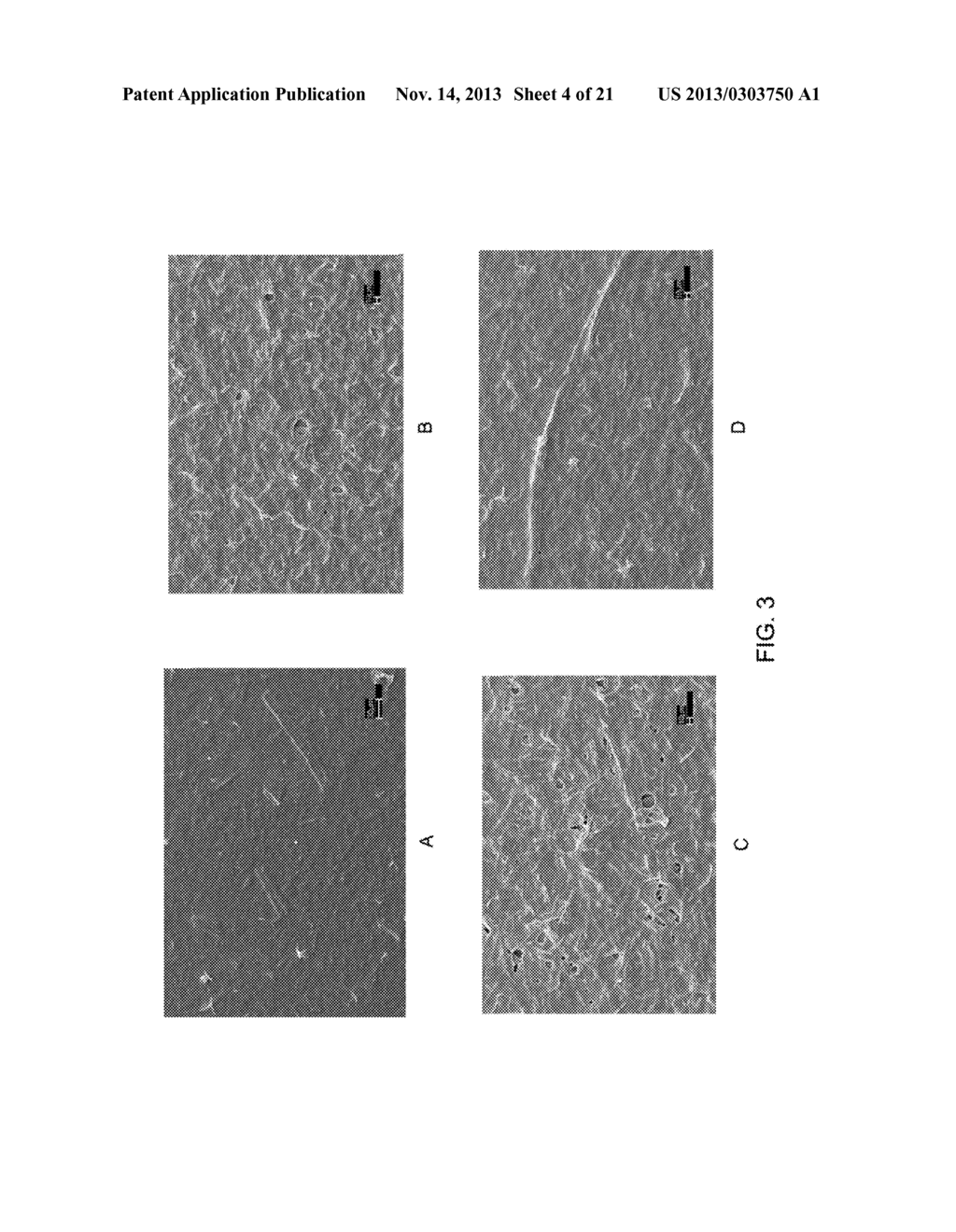 METHODS FOR INTEGRATING THE PRODUCTION OF CELLULOSE NANOFIBRILS WITH THE     PRODUCTION OF CELLULOSE NANOCRYSTALS - diagram, schematic, and image 05