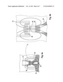 INJECTABLE LEADLESS HEART STIMULATION AND/OR MONITORING DEVICE diagram and image