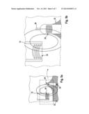 INJECTABLE LEADLESS HEART STIMULATION AND/OR MONITORING DEVICE diagram and image