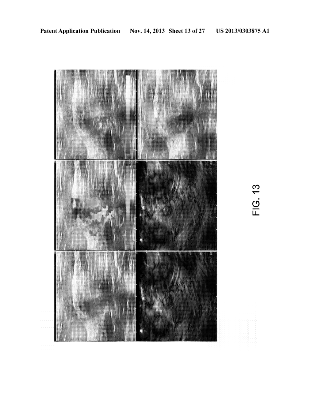 SYSTEM AND METHOD FOR DYNAMICALLY VARYING THE ANGLE OF LIGHT TRANSMISSION     IN AN OPTOACOUSTIC IMAGING SYSTEM - diagram, schematic, and image 14