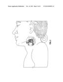 CAROTID BODY MODULATION PLANNING AND ASSESSMENT diagram and image