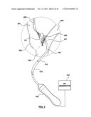 CAROTID BODY MODULATION PLANNING AND ASSESSMENT diagram and image