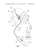 CAROTID BODY MODULATION PLANNING AND ASSESSMENT diagram and image