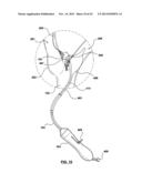 CAROTID BODY MODULATION PLANNING AND ASSESSMENT diagram and image