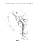 CAROTID BODY MODULATION PLANNING AND ASSESSMENT diagram and image