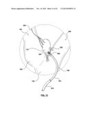 CAROTID BODY MODULATION PLANNING AND ASSESSMENT diagram and image