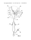 CAROTID BODY MODULATION PLANNING AND ASSESSMENT diagram and image