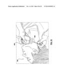 CAROTID BODY MODULATION PLANNING AND ASSESSMENT diagram and image