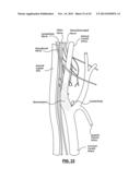 CAROTID BODY MODULATION PLANNING AND ASSESSMENT diagram and image