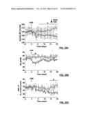 CAROTID BODY MODULATION PLANNING AND ASSESSMENT diagram and image