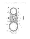 CAROTID BODY MODULATION PLANNING AND ASSESSMENT diagram and image