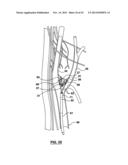 CAROTID BODY MODULATION PLANNING AND ASSESSMENT diagram and image