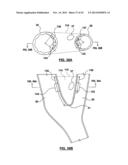 CAROTID BODY MODULATION PLANNING AND ASSESSMENT diagram and image