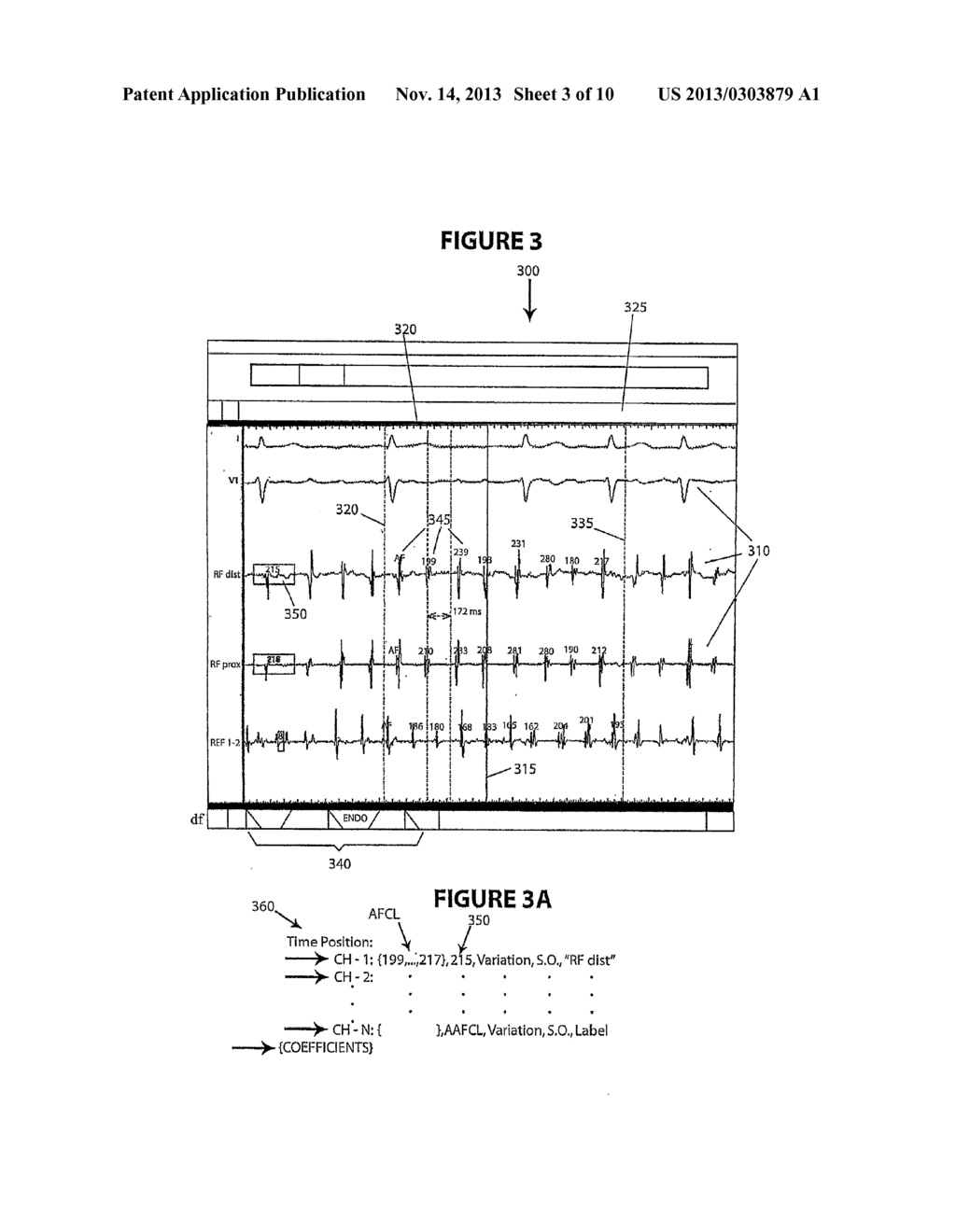 HIGH DENSITY ATRIAL FIBRILLATION CYCLE LENGTH (AFCL) DETECTION AND MAPPING     SYSTEM - diagram, schematic, and image 04