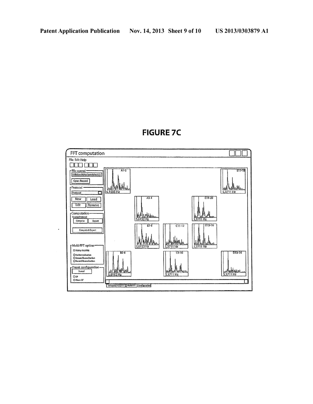 HIGH DENSITY ATRIAL FIBRILLATION CYCLE LENGTH (AFCL) DETECTION AND MAPPING     SYSTEM - diagram, schematic, and image 10