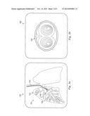 Systems and Methods for Registration of a Medical Device Using Rapid Pose     Search diagram and image