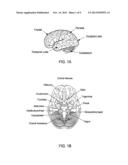 METHOD AND APPARATUS FOR TREATING VARIOUS NEUROLOGICAL CONDITIONS diagram and image