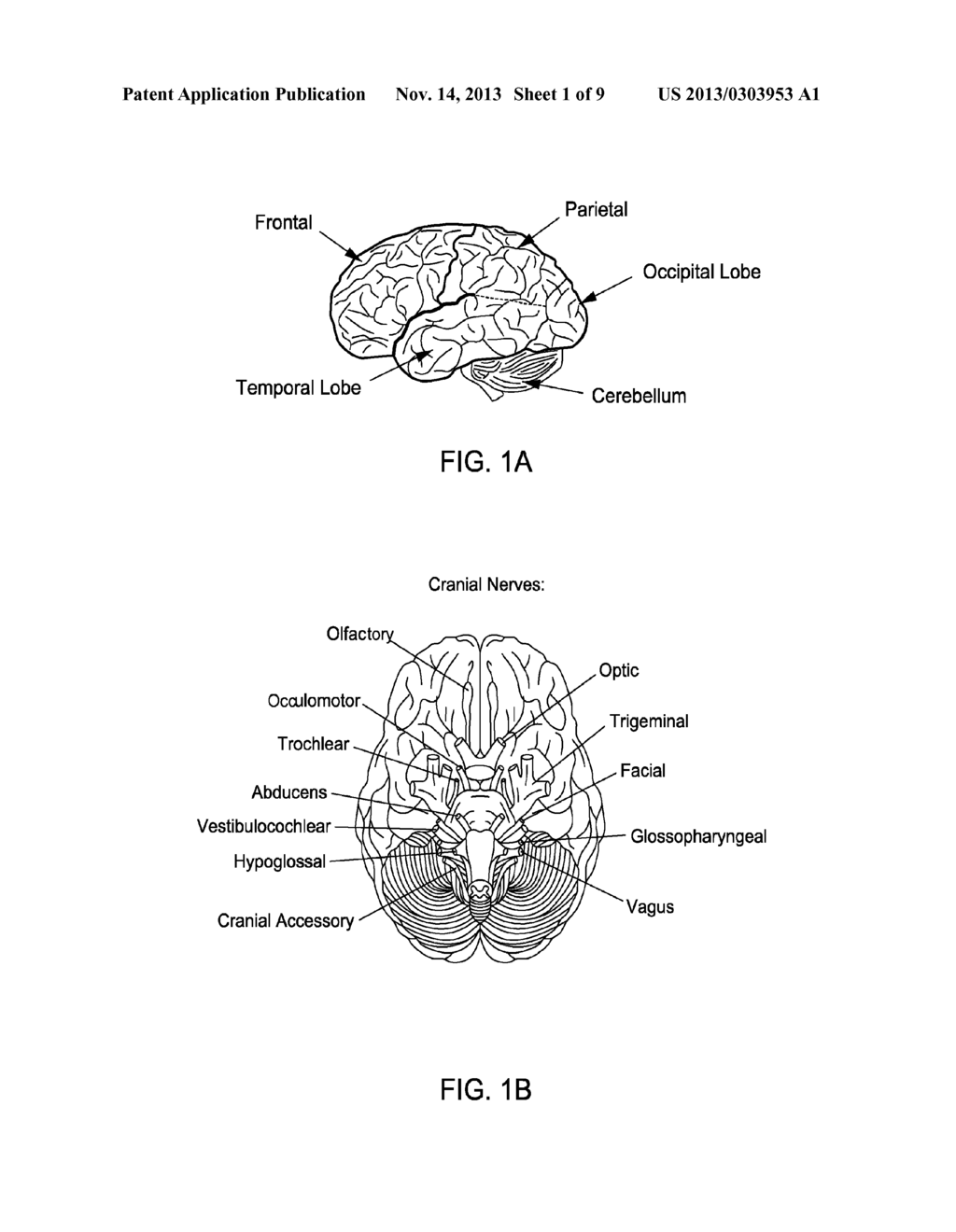 METHOD AND APPARATUS FOR TREATING VARIOUS NEUROLOGICAL CONDITIONS - diagram, schematic, and image 02