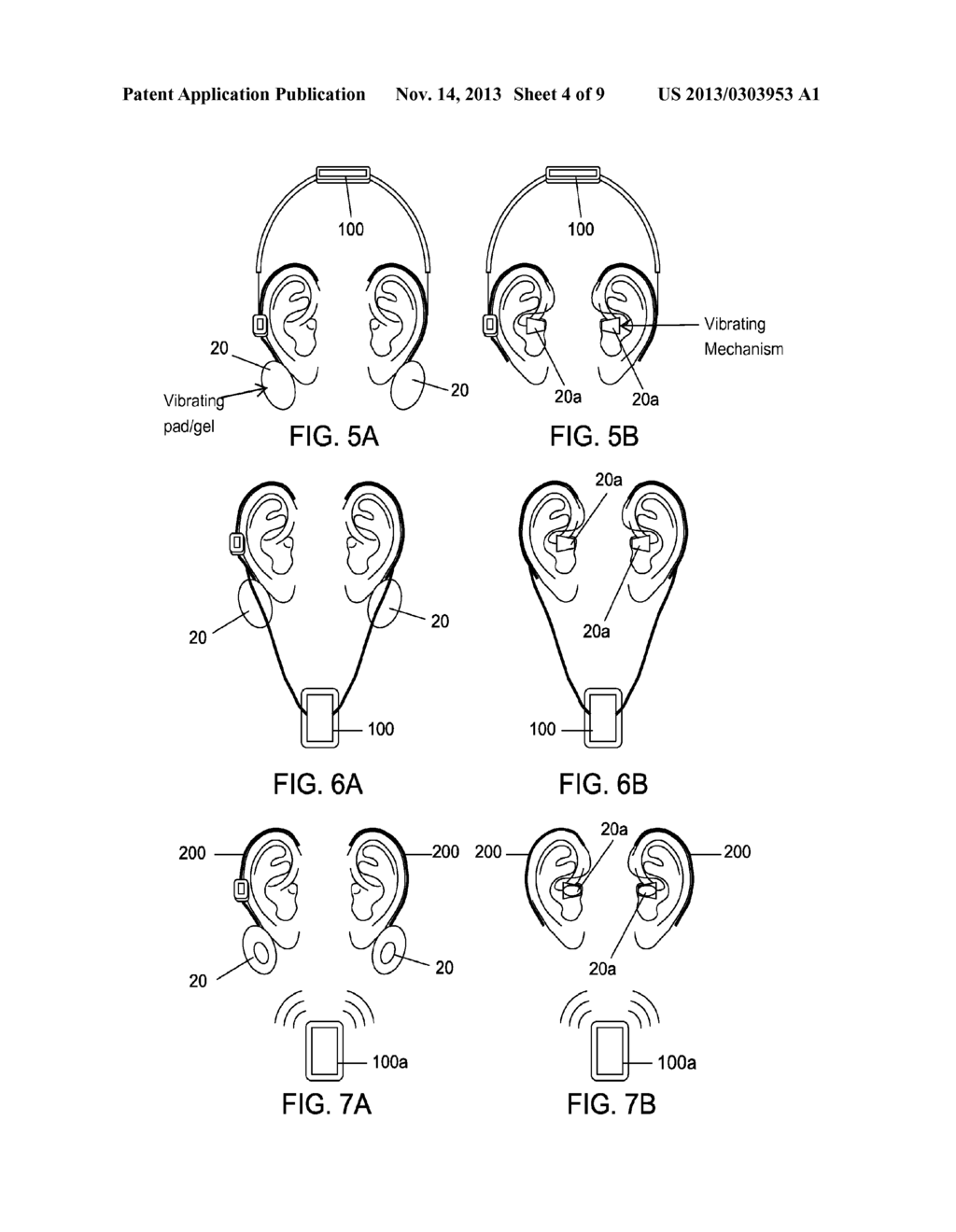 METHOD AND APPARATUS FOR TREATING VARIOUS NEUROLOGICAL CONDITIONS - diagram, schematic, and image 05