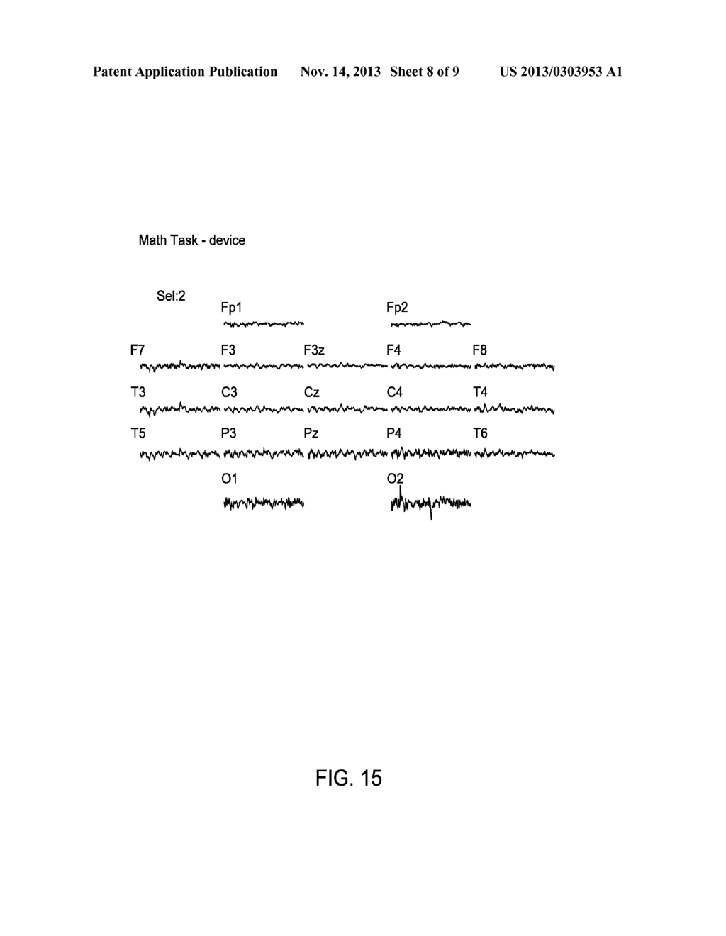 METHOD AND APPARATUS FOR TREATING VARIOUS NEUROLOGICAL CONDITIONS - diagram, schematic, and image 09