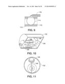 Arteriovenous Access Valve System and Process diagram and image