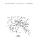 SYSTEM AND METHOD FOR TREATMENT OF NON-VENTILATING MIDDLE EAR BY PROVIDING     A GAS PATHWAY THROUGH THE NASOPHARYNX diagram and image