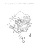 SYSTEM AND METHOD FOR TREATMENT OF NON-VENTILATING MIDDLE EAR BY PROVIDING     A GAS PATHWAY THROUGH THE NASOPHARYNX diagram and image