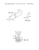 SYSTEM AND METHOD FOR TREATMENT OF NON-VENTILATING MIDDLE EAR BY PROVIDING     A GAS PATHWAY THROUGH THE NASOPHARYNX diagram and image