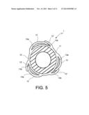 DRUG ELUTING BALLOON FOR THE TREATMENT OF STENOSIS AND METHOD OF     MANUFACTURING THE BALLOON diagram and image