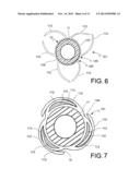 DRUG ELUTING BALLOON FOR THE TREATMENT OF STENOSIS AND METHOD OF     MANUFACTURING THE BALLOON diagram and image