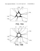 DRUG ELUTING BALLOON FOR THE TREATMENT OF STENOSIS AND METHOD OF     MANUFACTURING THE BALLOON diagram and image