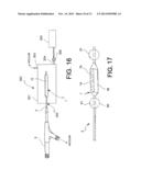 DRUG ELUTING BALLOON FOR THE TREATMENT OF STENOSIS AND METHOD OF     MANUFACTURING THE BALLOON diagram and image