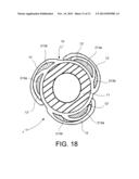 DRUG ELUTING BALLOON FOR THE TREATMENT OF STENOSIS AND METHOD OF     MANUFACTURING THE BALLOON diagram and image