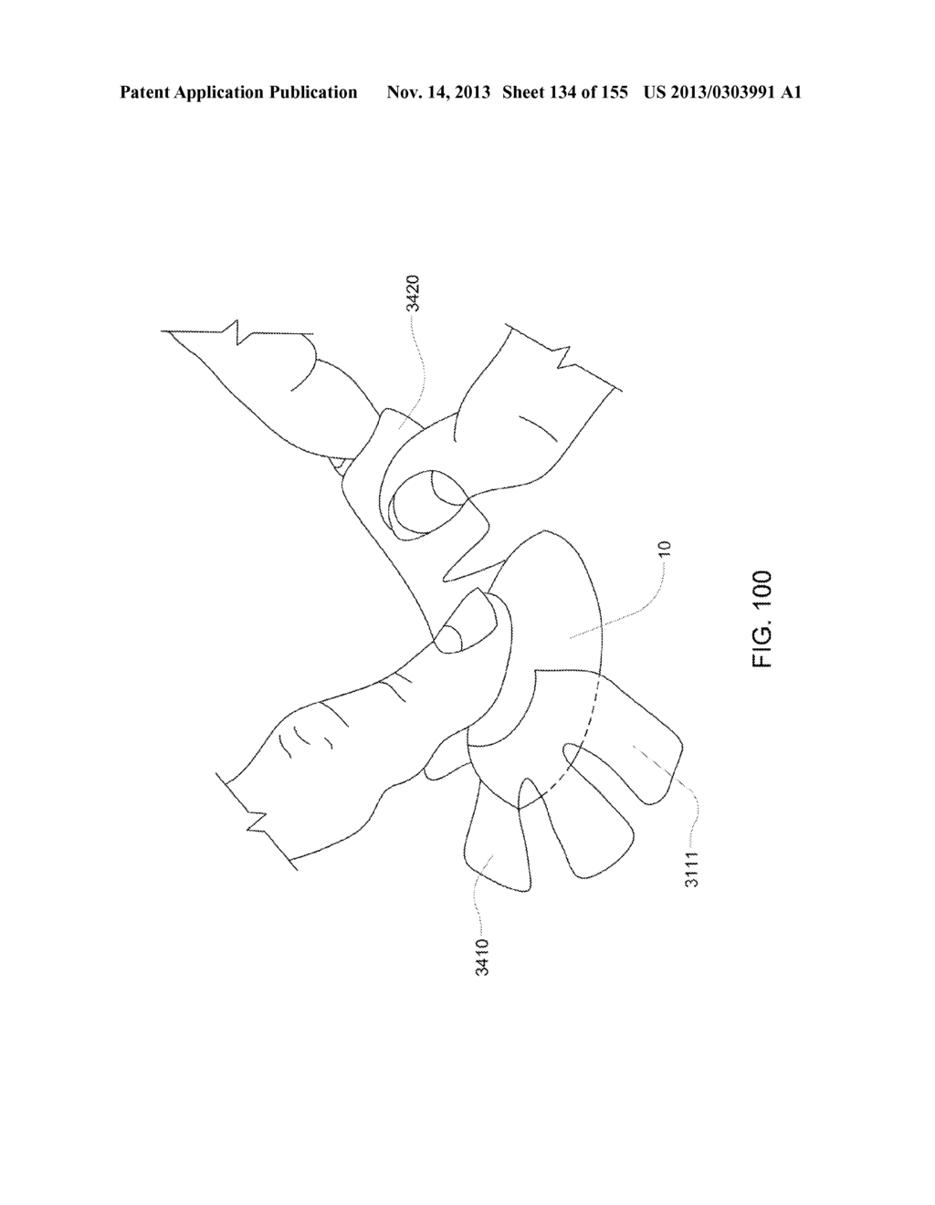 Adhesive and Peripheral Systems and Methods for Medical Devices - diagram, schematic, and image 135