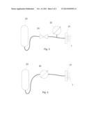 Needle Cannula with a Collapse Zone diagram and image