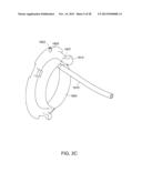 OSTOMY APPLIANCE diagram and image