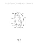 OSTOMY APPLIANCE diagram and image