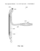 OSTOMY APPLIANCE diagram and image