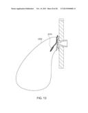 OSTOMY APPLIANCE diagram and image