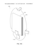 OSTOMY APPLIANCE diagram and image