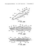 DIALYSIS CATHETER diagram and image