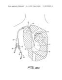 DIALYSIS CATHETER diagram and image