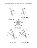 DIALYSIS CATHETER diagram and image