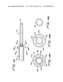 DIALYSIS CATHETER diagram and image