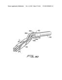 DIALYSIS CATHETER diagram and image